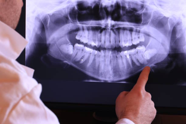 Best Emergency Treatment for Oral Infections in Hyrum, UT