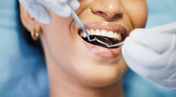 Best Dental Abscess Treatment in Hyrum, UT